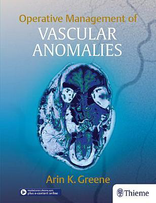 Picture of Operative Management of Vascular Anomalies