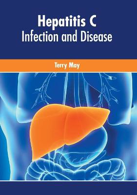 Picture of Hepatitis C: Infection and Disease