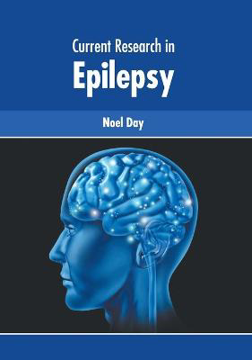 Picture of Current Research in Epilepsy