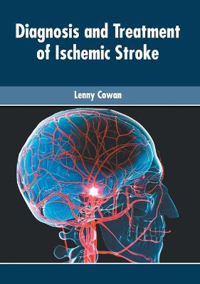 Picture of Diagnosis and Treatment of Ischemic Stroke