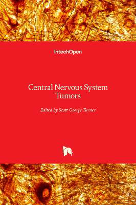 Picture of Central Nervous System Tumors