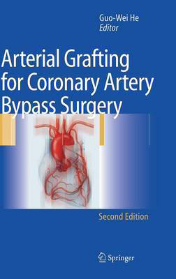 Picture of Arterial Grafting for Coronary Artery Bypass Surgery