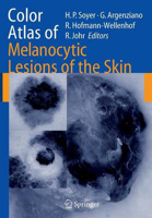 Picture of Color Atlas of Melanocytic Lesions of the Skin