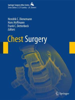 Picture of Chest Surgery