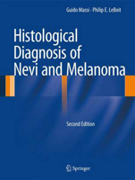 Picture of Histological Diagnosis of Nevi and Melanoma