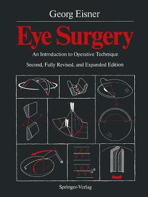 Picture of Eye Surgery: An Introduction to Operative Technique