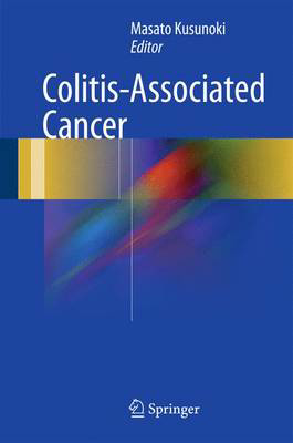 Picture of Colitis-Associated Cancer