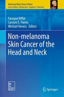 Picture of Non-melanoma Skin Cancer of the Head and Neck