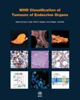 Picture of WHO classification of tumours of endocrine organs