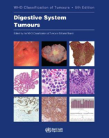 Picture of WHO Classification of Tumours. Digestive System Tumours: WHO Classification of Tumours, Volume 1