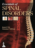 Picture of Essentials of Spinal Disorders