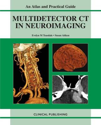 Picture of Multidetector CT in Neuroimaging