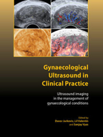 Picture of Gynaecological Ultrasound in Clinical Practice: Ultrasound Imaging in the Management of Gynaecological Conditions