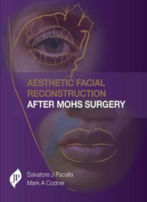 Picture of Aesthetic Facial Reconstruction After Mohs Surgery