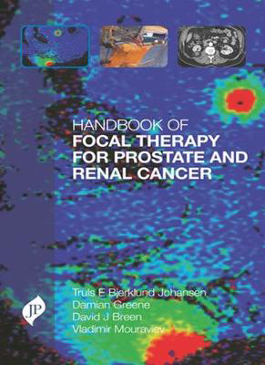 Picture of Handbook of Focal Therapy for Prostate and Renal Cancer