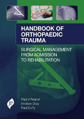 Picture of Handbook of Orthopaedic Trauma