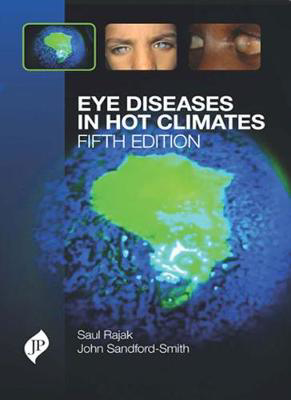 Picture of Eye Diseases in Hot Climates