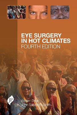 Picture of Eye Surgery in Hot Climates