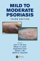 Picture of Mild to Moderate Psoriasis