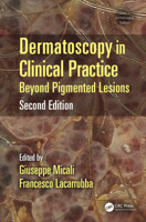 Picture of Dermatoscopy in Clinical Practice: Beyond Pigmented Lesions