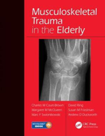 Picture of Musculoskeletal Trauma in the Elderly