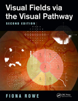 Picture of Visual Fields via the Visual Pathway