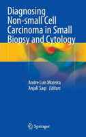 Picture of Diagnosing Non-small Cell Carcinoma in Small Biopsy and Cytology