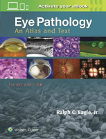 Picture of Eye Pathology: An Atlas and Text