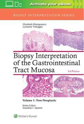 Picture of Biopsy Interpretation of the Gastrointestinal Tract Mucosa: Volume 1: Non-Neoplastic