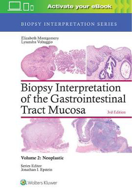 Picture of Biopsy Interpretation of the Gastrointestinal Tract Mucosa: Volume 2: Neoplastic