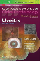Picture of Uveitis