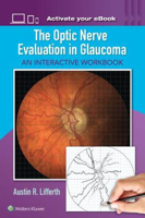 Picture of The Optic Nerve Evaluation in Glaucoma: An Interactive Workbook