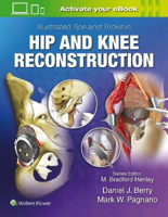 Picture of Illustrated Tips and Tricks in Hip and Knee Reconstructive and Replacement Surgery