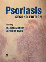 Picture of Psoriasis