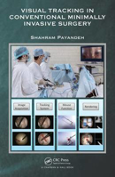 Picture of Visual Tracking in Conventional Minimally Invasive Surgery