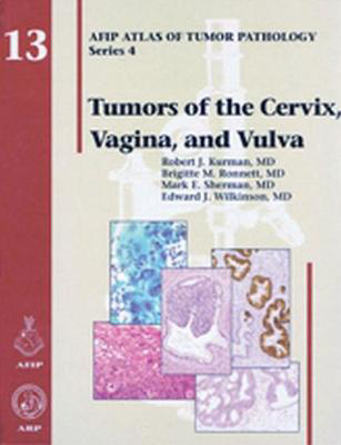 Picture of Tumors of the Cervix, Vagina, and Vulva