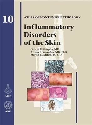 Picture of Inflammatory Disorders of the Skin