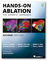 Picture of Hands-On Ablation: The Experts' Approach