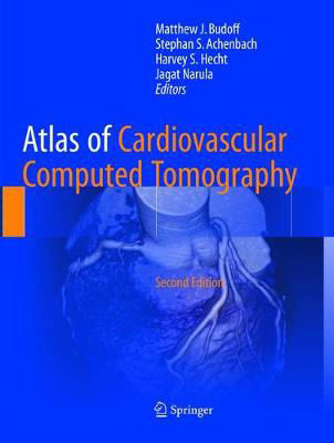 Picture of Atlas of Cardiovascular Computed Tomography