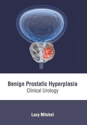 Picture of Benign Prostatic Hyperplasia: Clinical Urology