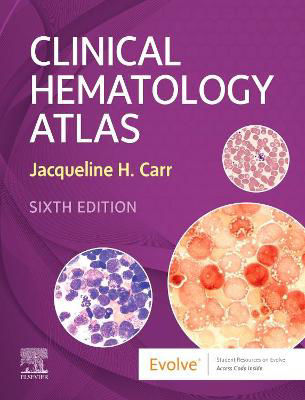 Picture of Clinical Hematology Atlas