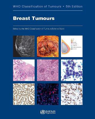 Picture of WHO Classification of Breast Tumours: WHO Classification of Tumours, Volume 2