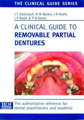 Picture of A Clinical Guide to Removable Partial Dentures