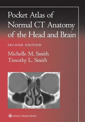 Picture of Pocket Atlas of Normal CT Anatomy of the Head and Brain