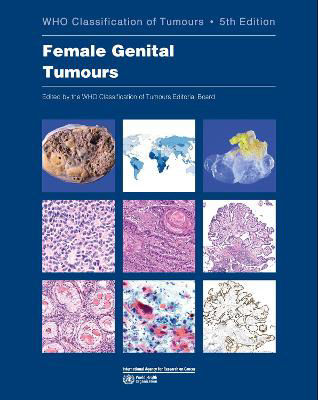 Picture of WHO classification of female genital tumours