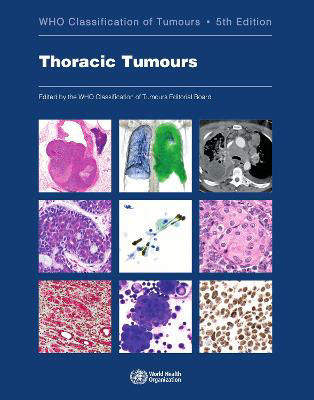 Picture of Thoracic tumours