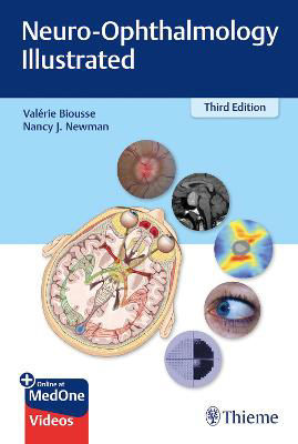 Picture of Neuro-Ophthalmology Illustrated