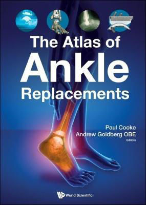 Picture of Atlas Of Ankle Replacements, The